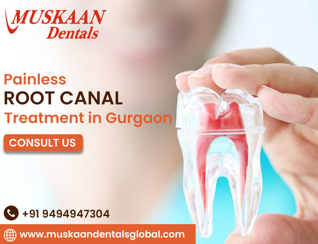 Painless Root Canal Treatment in Gurgaon