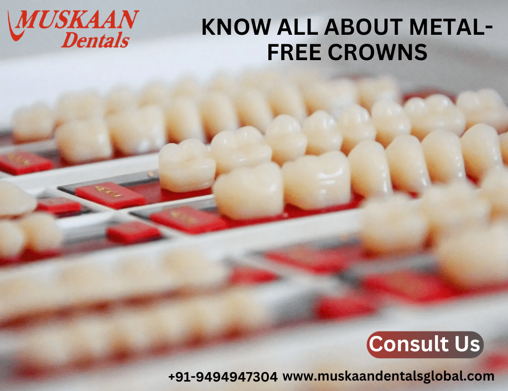 Know All About Metal-Free Crowns